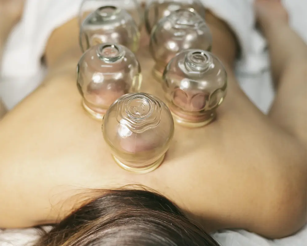 Dynamic Cupping | Maryam Aquatics & Bodyworks