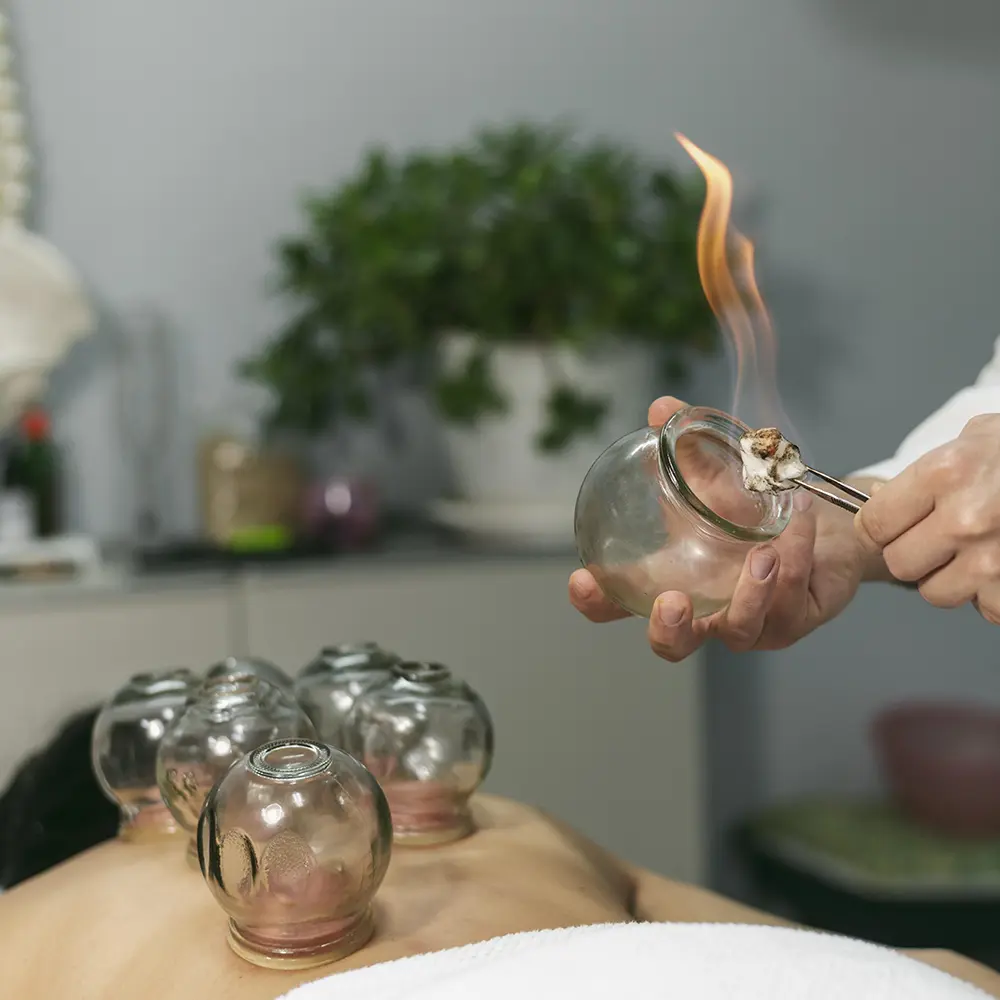 Dynamic Cupping Therapy San Diego